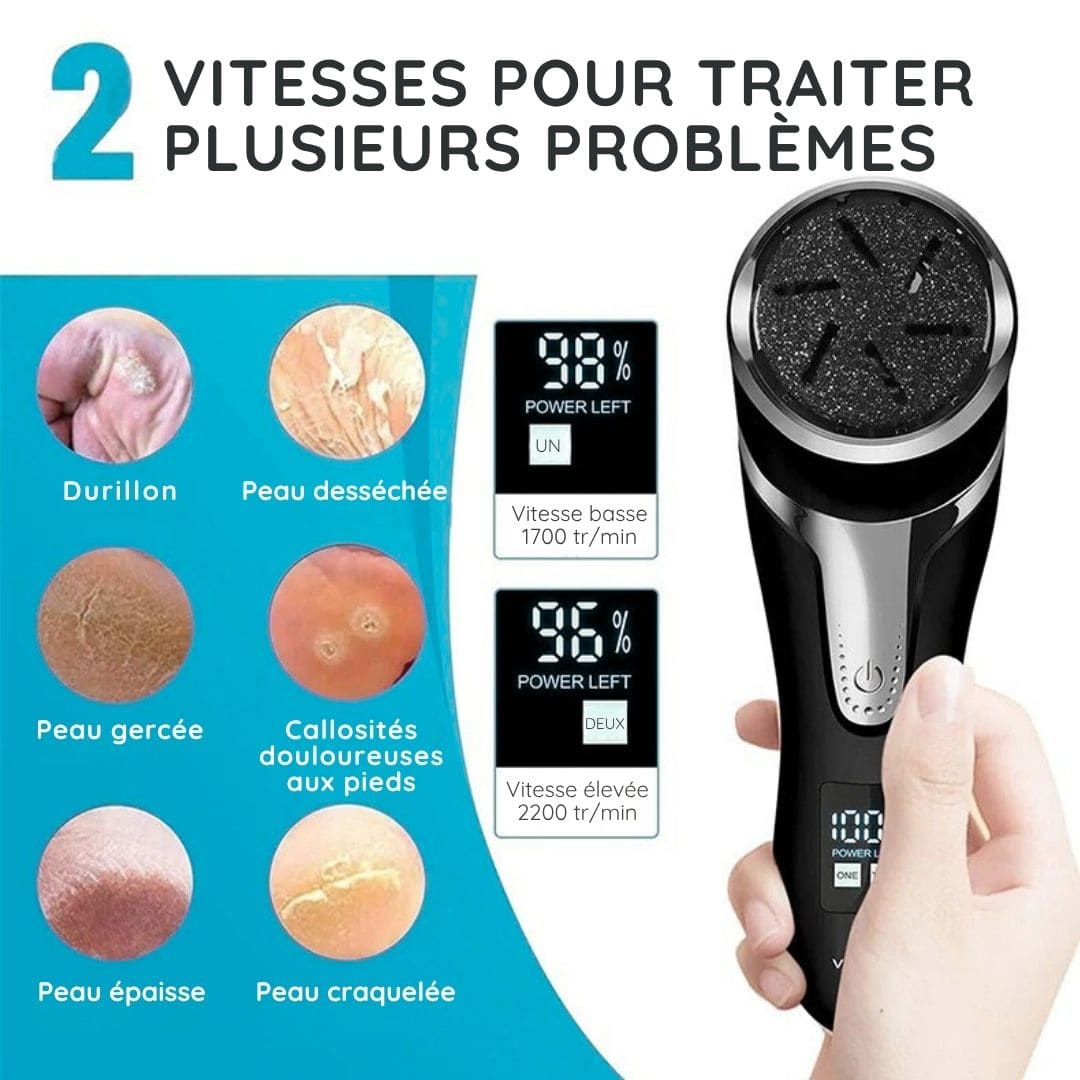 Râpe Électrique Anti Callosités pour les Pieds - Sans fil et sans douleur