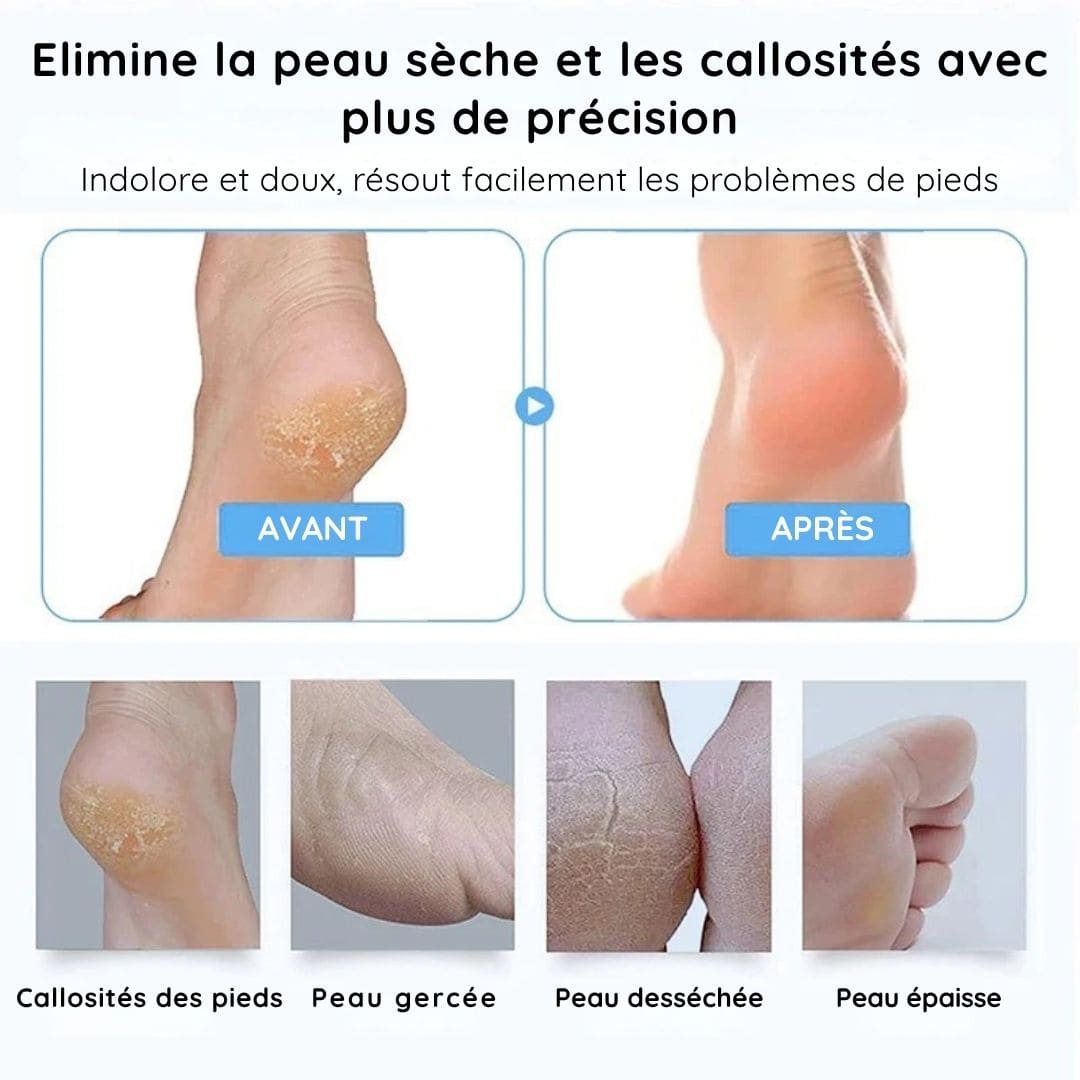 Râpe Électrique Anti Callosités pour les Pieds - Sans fil et sans douleur