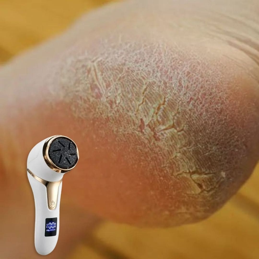 Râpe Électrique Anti Callosités pour les Pieds - Sans fil et sans douleur