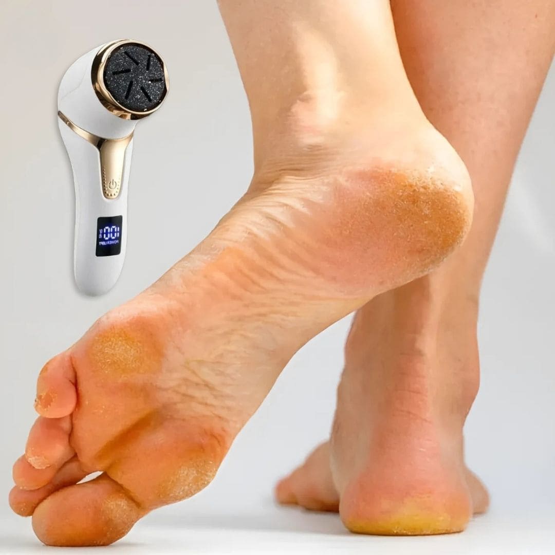 Râpe Électrique Anti Callosités pour les Pieds - Sans fil et sans douleur