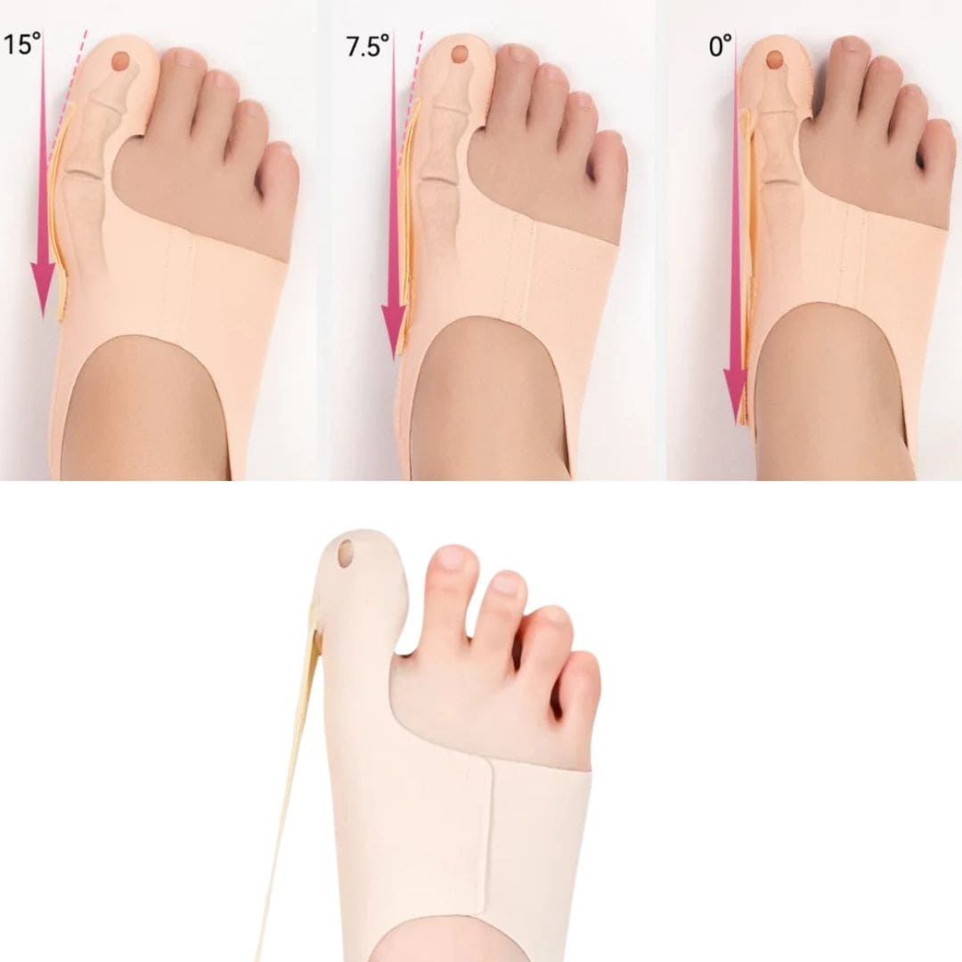 Orthèse Chaussette Discrète et Légère pour Hallux Valgus - OrthoZen™